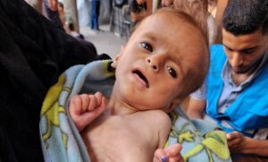 https://www.unrwa.org/newsroom/blog/clock-ticking-fast-starving-children-gaza-will-world-take-action-save-them